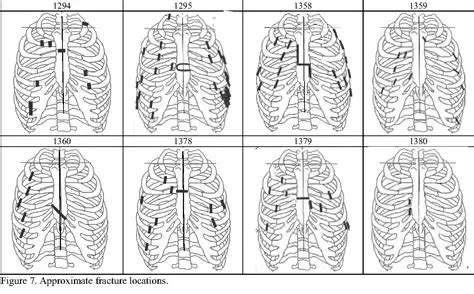 Advanced Skeletal Deformation