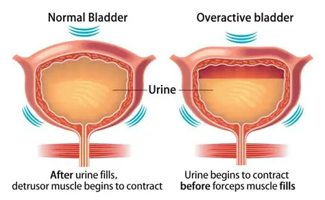 Bladder muscle overactivity