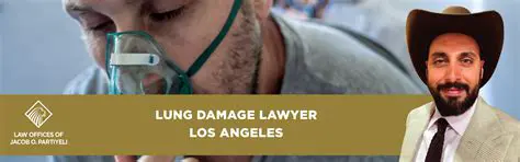 Chicago Car Accident Damage Lawyer: Navigating Your Claim with Expert Legal Counsel