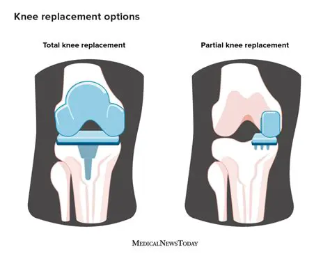 Is Knee Plural? Unpacking the Anatomy and Etymology of Your Knees