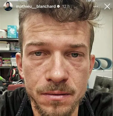 Mathieu Blanchard : L'ascension fulgurante d'un ultra-trailer québécois