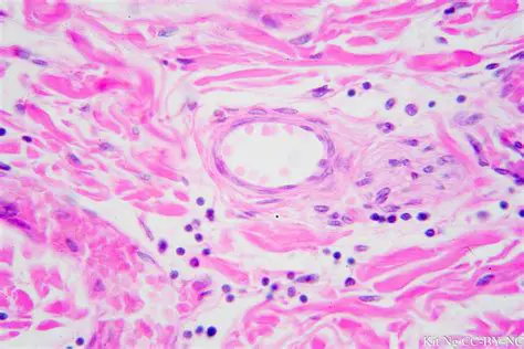 Simple Squamous Epithelium