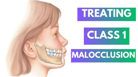 Understanding Malocclusion and Orthodontic Care Needs