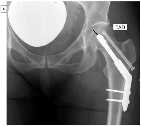 Using Fracture in Your Projects